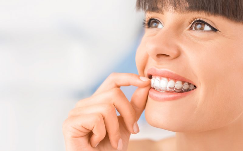 Image of girl with invisalign clear aligner